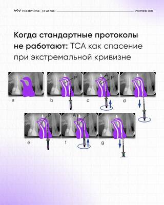 Тактильная активация: контроль в изогнутых каналах.